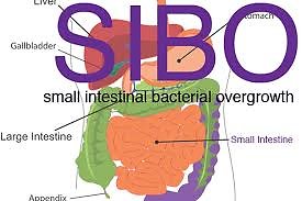 SIBO (Small Intestinal Bacterial Overgrowth). SIbo Image (not me)